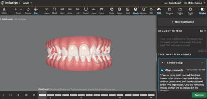 Clincheck de Invisalign Tenerife en Dr. Cristo Bacallado